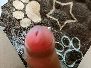 Urethrale Masturbatie