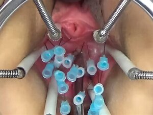 Extreme German BDSM Needles Inner Pussy Cervix And Tits Porn