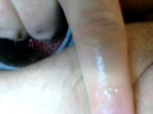 Prolaps Rozeknop Buttplug